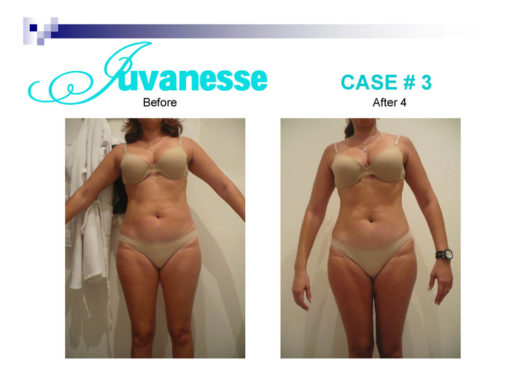 Before-and-After-Presentation-2_Page_07-510×382